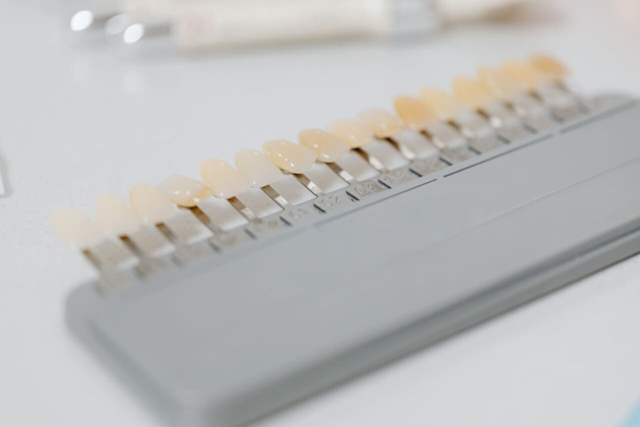 https://scrascia.net/wp-content/uploads/2025/02/Faccette-dentali-1280x854.jpg