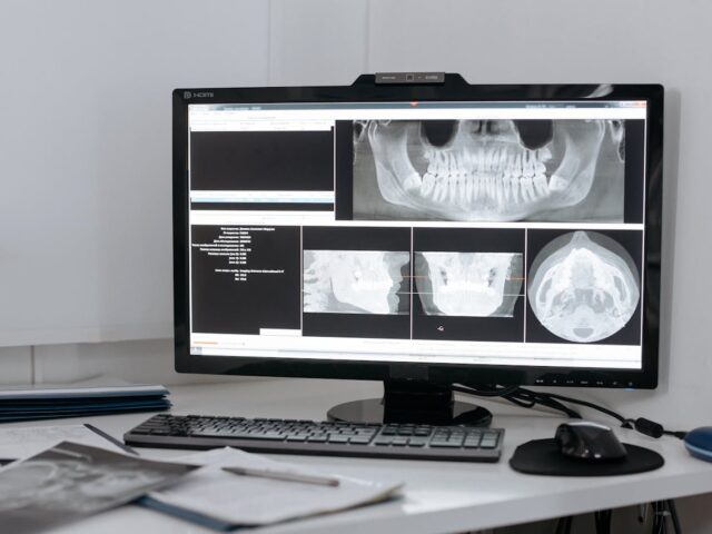 Odontoiatria digitale: come la tecnologia migliora le cure dentali